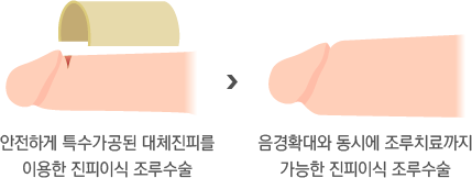 Ű溸 
